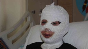 Sobada ayaklarını ısıtırken kendini yaktı