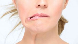 Soğuk hava yüz felcini arttırıyor