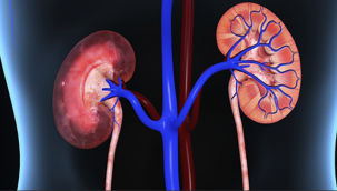 'Böbreğinizin sağlığını korumak için bol su için'