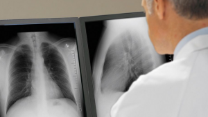 Aşırı telefon ve bilgisayar kullanımı akciğerleri söndürüyor