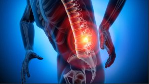 Fıtıkta erken tanı ve teşhisi çok önemli 