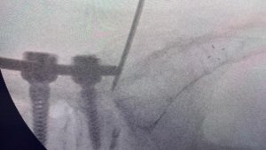 Türk doktor, bulduğu yöntemle literatüre girdi