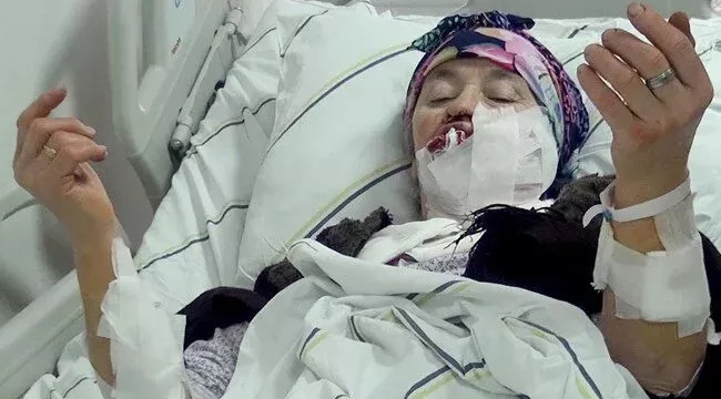 Tortum Kireçli'de kurt saldırdı