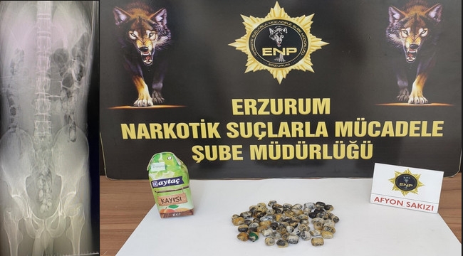 Uyuşturucuyu mide ve bağırsaklarına saklamış