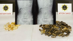 Uyuşturucu kapsüllerini mideye zulalamış