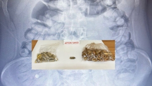 Bu uyuşturucuyu karnına zulalamış