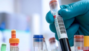 Demans ve ALS Hastalarına Umut Olacak Çalışma