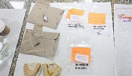 Dokuz Eylül'den diş protezi analizi için yerli referans malzeme