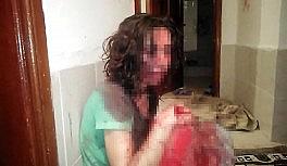 Eşini öldüresiye dövdü, 'kendi kendine yapmıştır' dedi